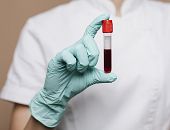 Podziel się życiem pod VIVO! Krosno. Wiosenna akcja krwiodawstwa już 14 marca